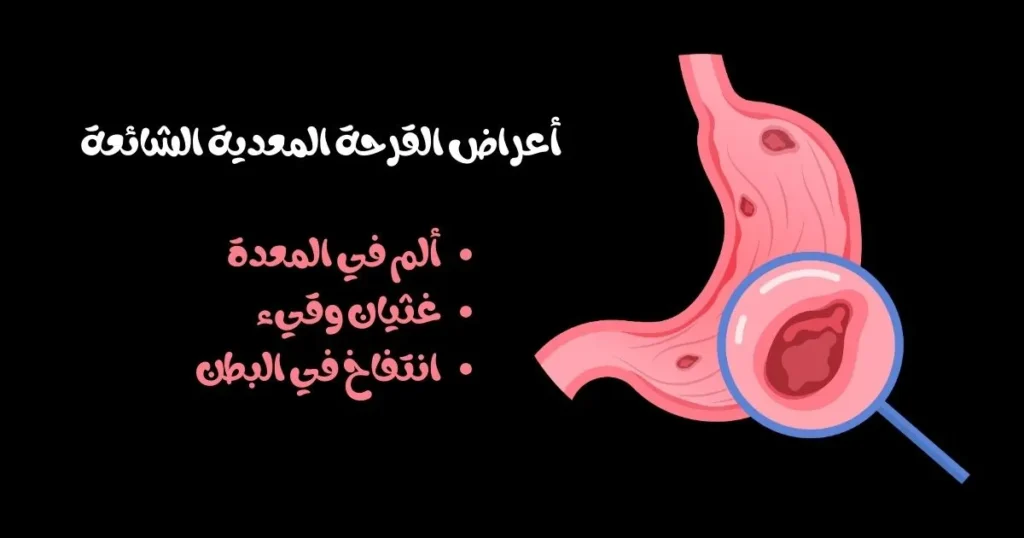 أعراض القرحة المعدية الشائعة