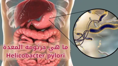 ما هي جرثومة المعدة Helicobacter pylori